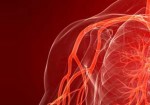 angiologia-aguas-lindas-de-goias-1385822612