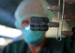 radiografia-odontologia-aguas-lindas-de-goias-1385837237