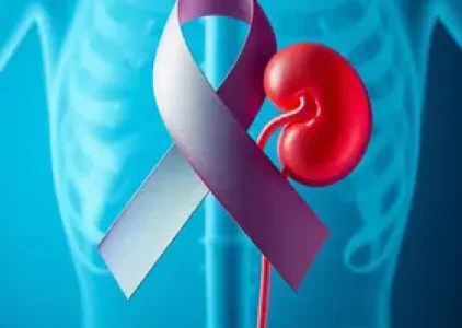 câncer renal em metástase